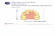 O multidisciplinaria) - Ortocervera Cursos de Ortodonciaortocervera.com/wp-content/uploads/2014/12/17-01-Tipodonto-ORTOD... · Texto. Dibujo Digital: ... (Ortodoncia multidisciplinaria)