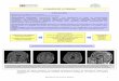 La imagen de la semana IX -   · PDF fileEl diagnóstico definitivo se basa e ... VIII y II. Diagnóstico ... Mecanismos de entrada de células