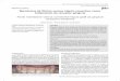 reporte clínico Membrana de fibrina versus injerto ... · PDF fileMembrana de fibrina versus injerto conectivo como tratamiento de recesión gingival Fibrin membrane versus connective