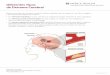 Diferentes Tipos de Derrame Cerebral - …mercyhealthneuro.com/uploads/files/GR-Stroke... · Ambos impiden que la sangre (y con ella el oxígeno y los ... (anticoagulantes o diluyentes
