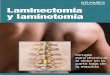 Laminectomía y laminotomía (PDF) · PDF fileEsto sirve para determinar la cantidad de anestesia que necesitará para "dormir" durante la cirugía. Riesgos de la cirugía Como sucede