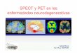 SPECT y PET en las enfermedades neurodegenerativasnucleus.iaea.org/HHW/NuclearMedicine/Neurology/IAEATrainingCourses/... · diagnÓstico diferencial de las demencias patologia spet