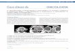 Caso clínico de ONCOLOGÍA - clinvetpeqanim.com · pueden observarse exoftalmos y signos neurológicos causados por la invasión intracraneal, generalmente a través del etmoides.1,2