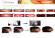 Tratamientos de ortopedia maxilar - clinicasvuka.comclinicasvuka.com/pdf/dental/tratamientos de ortopedia maxilar.pdf · Tratamientos de ortopedia maxilar Tratamiento ortopédico