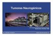 Presentaciones-Tumores neurogenicos BsAs 2009€¦ ·  · 2009-11-02Tumores neurogénicos • Tejidos derivados de la cresta neural • 80-95% de los tumores de mediastino posterior