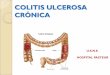 COLITIS ULCEROSA CRÓNICA esclerosante primaria (manifestación más grave) CURSO DE LA CUC IBSEN STUDY Solberg IC, et al. Scand J Gastroenterol. 2009;44:431-440. 55% 0 5 años 1%