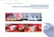 Ciencia y práctica - Maxillaris y práctica Fig. 1. Proceso fistuloso crónico y tinción por amalgama de la encía adherida debido a una apicectomía defectuosa con áreas periapicales