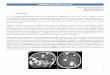 Tumores Malignos del SNC - medicina-ucr.commedicina-ucr.com/.../2015/09/7.-Tumores-Malignos-del-SNC-NQX.pdf · 2 TUMORES MALIGNOS DEL SNC II. Tumores Primarios del SNC Se utiliza