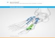 Sistema de placas de osteosíntesis para antepié y … · Escariado de la falange proximal. Técnica uirúrgica del istema de placas de osteosíntesis para antepi y mesopi de cumed