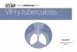 VIH y tuberculosis€¦ · VIH y tuberculosis Este folleto proporciona información básica sobre la tuberculosis (TB) y sobre qué puede suponer para ti la coinfección por VIH y