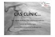 CAS CLÍNIC… - academia.cat · ‐Angina estable des de 1991 ‐2006: Coronariografia Æsense lesions significatives ‐2009: AC x FA paroxística ÆAnticoagulació oral Acenocumarol