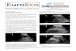 Vol 7(1) 1616 - Revista digital de Ecografía Clínicaeuroeco.org/vol7_num1_marzo2016/pdf/9_10.pdf · sos se encuentra una obstrucción pielo-ureteral bilateral. ... rénquima renal