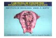 ESTADIFICACION Y TRATAMIENTO QUIRURGICOigmdp.com.ar/old/download/educmedica/diapositivas/Carcinoma de... · Citología exfoliativa cervico-vaginal ... Extensión cervical Diseminación
