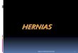 HERNIAS - ecaths1.s3.amazonaws.comecaths1.s3.amazonaws.com/tecnicasquirurgicas1/HERNIAS.pdf · DE LAS HERNIAS ABDOMINALES El tratamiento quirúrgico se realiza en cuatro pasos: 1-