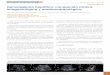 Hemangioma hepático: correlación clínica, … · Enero 2014 (vol 3, num 1) 13 venosa y tardía. Este comportamiento dinámico se observa en los hemangiomas hepáticos (figura 2)