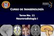 Tema No. 11 Neuroradiología I - medicina.uanl.mx · estar asociado a Osteogénesis imperfecta, Raquitismo, ... molecular que combinado ... La hemorragia subaracnoidea se visuliza