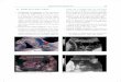 Diagnóstico de la patología fetal 69 - Editorial Amolca ... · previos o conización, y las variantes anatómicas que conducen a estructura defectuosa del ani- llo ... el abdomen