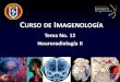 Curso de Imagenología - medicina.uanl.mx · Lesiones extra-axiales Hematoma Subdural Hematoma Epidural 