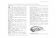 TOPOGRAFÍA CRANEOENCEFÁLICA Y ANATOMÍA DE … · TÉCNICA’QUIRÚRGICA’ Rev. Neurociencias Vol. 1 Num. 2 Septiembre 1997 3 Figura3(trazos’paraventrículos’y’núcleos’