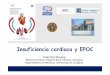 Insuficiencia cardiaca y EPOC - fesemi.org · • Ecocardiograma. ... • ¿Qué inconvenientes tienen los IECAs? ... • 3 meses después del alta Anomalía Prevalencia Dilatación