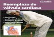 Reemplazo de válvula cardíaca (PDF) - My HealtheVet ... · Dentro de su corazón, la sangre pasa a través de una serie de caminos de una sola mano llamados válvulas. Si una válvula