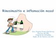 Rinosinusitis e inflamación nasal - cscontruecesvega · INFLAMACIÓN DE LAS FOSAS Y LOS SENOS PARANASALES ... Añadir corticoides tópicos nasales Tratamiento de la rinosinusitis