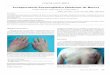 Acroqueratosis Paraneoplásica (Síndrome de Bazex)scielo.isciii.es/pdf/sm/v71n4/comunicacion_breve1.pdf · con paraqueratosis y migración de neutrófilos hacia la epidermis y discreto