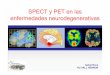 SPECT y PET en las enfermedades neurodegenerativas · nÚmero de personas con demencia en los paises desarrollados y en ... spect tipo imagen pet 99mtc-hmpao perfusiÓn 15o-h2o 99mtc-ecd