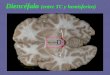Diencéfalo (entre TC y hemisferios) · Del tálamo las proyecciones vuelven a la corteza. La actividad de estos circuitos en el control del movimiento está modulada por la participación
