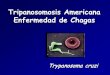 Tripanosomosis Americana Enfermedad de Chagaspatologiaclinicamexicana.org.mx/pdfs/memo/EnfermedaddeChagas2015.pdf · Romaña-Mazza Chagoma de inoculación. Signo de Romaña-Mazza