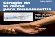 Cirugía de la mano para tenosinovitis (PDF) · Ésta incluye su historia clínica, un examen de la mano ... con lo cual podrá programar la operación para cuando le resulte 