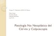 Atlas. Patología No Neoplásica del Cérvix y Colposcopía · Una biopsia dirigida por colposcopia para confirmar la afección. Procedimiento de escisión por LEEP, el cual utiliza