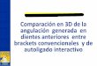 Presentación de PowerPoint - Universidad Autónoma de ...repositorio.autonoma.edu.co/jspui/bitstream/11182/625/1... · brackets de autoligado interactivo en los incisivos centrales,