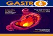 FASCÍCULO DE ENFERMEDADES GASTROINTESTINALES No · 3 Fascículo de Enfermedades Gastrointestinales No.13 Epidemiología y síntomas ca puede gatillar relajaciones transitorias del