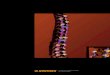 Sistema Pangea para columna vertebral. Sistema de ...synthes.vo.llnwd.net/o16/LLNWMB8/INT Mobile/Synthes International... · un esqueleto maduro. Indicaciones – Enfermedad discal