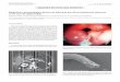 Diagnóstico parasitológico directo de infección por ...scielo.isciii.es/pdf/diges/v107n11/es_imagenes2.pdf · en un caso de epigastralgia Yolanda González-Amores 1, Encarnación