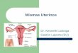 Miomas Uterinosloaiciga.com/documentos/miomas_uterinos.pdf · –Situados bajo el peritoneo visceral uterino ... – El mioma puede impedir la fecundación o la implantación