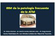 IRM de la patología frecuente de la ATM - IMAGENES 2015 · Guralnick W, Kaban LB, Merrill RG. Temporomandibular joint afflictions.NEnglJMed1978;299:123–129. 3. Solberg WK, Woo