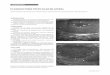 PLASMOCITOMA TESTICULAR BILATERAL CONCLUSIÓN …hpc.org.ar/images/revista/878-60-Plasmocitoma testicular.pdf · Plasmocitoma extramedular (pared anterior del tórax y piel de muslo)
