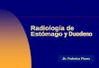 Radiología de Estómago y Duodeno - FMV - UBA · pared posterior Esofago Compresiones fisiologicas del botón aortico , hilio izquierdo . Masas mediastinicas, ewtructuras oseas