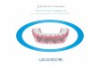 Sonrisa segura - Zimmer Biomet Homebiomet3i.es/Resource Center/Brochures/Overdenture Brochure_ART1261S_ES.pdf · dentales aumentará en un 13% para 2020 respecto a 1991.2 • Aproximadamente