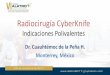 Presentación de PowerPoint · 2018-01-02 · SBRT Radioterapia Estereotactica Corporal •Es un concepto de Radioterapia Externa usado para depositar Altas dosis de radiación, a