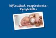 Dificultad respiratoria: Epiglotitis - Área Salud Badajoz · Epiglotitis Dignóstico: clínico. Evitar la exploración de la cavidad oral ni realización de analítica ya que al