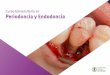 Curso Universitario en Periodoncia y Endodoncia · única, clave y decisiva para impulsar tu desarrollo profesional” 3.3.ratamiento no quirúrgico de la enfermedad periodontal