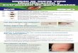 CIUDAD DE NUEVA YORK Identificación y extracción de garrapatas · Signos y síntomas de las enfermedades transmitidas por las garrapatas • Enfermedad de Lyme: Los síntomas incluyen