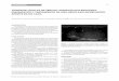 TUMOR DE CÉLULAS DE SERTOLI: VARIANTE ESCLEROSANTE ... NAZAR.pdf · peritonitis esclerosante obstructiva o peritonitis calcificada, es una rara pero grave complicación de los pacientes