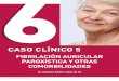CASO CLÍNICO 5 · PAROXÍSTICA Y OTRAS COMORBILIDADES ... • Mujer de 79 años acude a Urgencias por disnea progresiva de una semana de evolución, acompañada de tos seca sin expectoración,