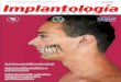 Editorial Acmibm.org/documentos/Implantologia_23.pdf · 2018-04-23 · de los implantes dentales, que han permitido revolucionar y mejorar la rehabilitación orofacial. Con relación