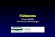Melanoma - Sociedad Valenciana de Cirugíasociedadvalencianadecirugia.com/.../03/melanoma_maligno.pdf · 2017-04-28 · Factores de riesgo de pedecer un MM 1. Pelo rubio claro o rojo