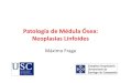 Patología de Médula Ósea: Neoplasias Linfoides · 2013-07-11 · Neoplasias Linfoides Máximo Fraga . Linfomas en médula ósea 1. Consideraciones generales 2. Infiltrados linfoides